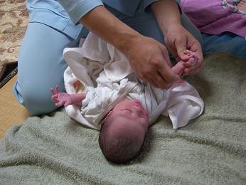 出産直後に小児鍼をしている写真